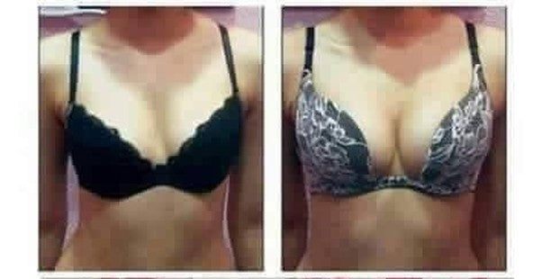 Breast Enlargement & Tightening Capsules - (GET RID OF SMALL BREASTS) (also good for Asymmetrical Breast)