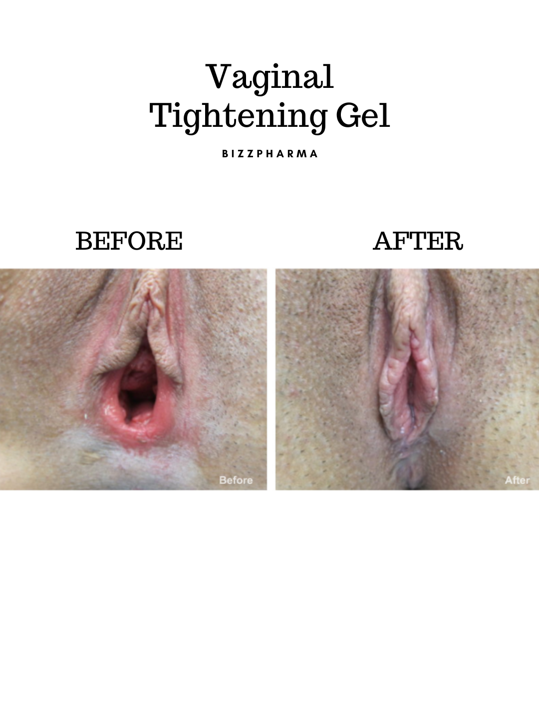 Vaginal Tightening Gel (Best for Tightness) Imported