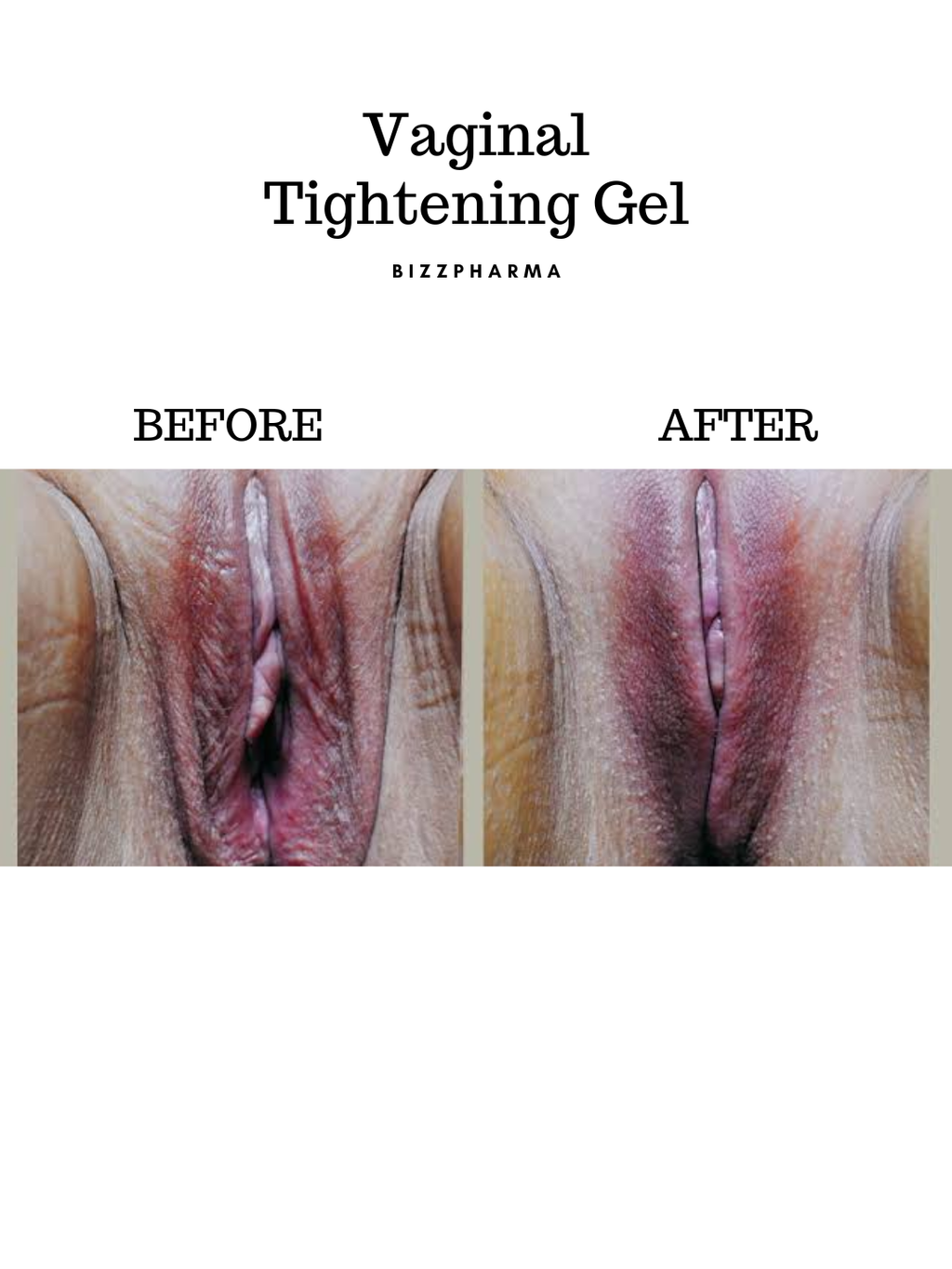 Vaginal Tightening Gel (Best for Tightness) Imported