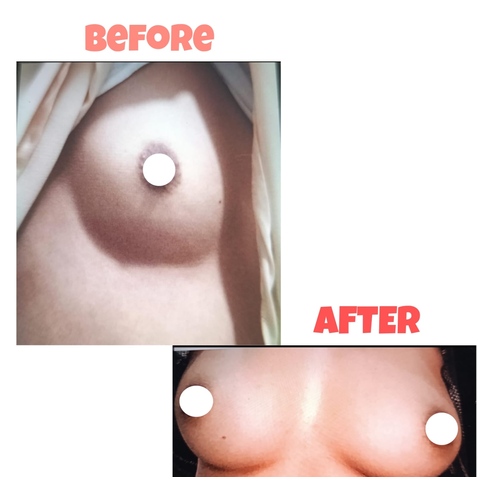 Breast Enlargement & Tightening Capsules - (GET RID OF SMALL BREASTS) (also good for Asymmetrical Breast)