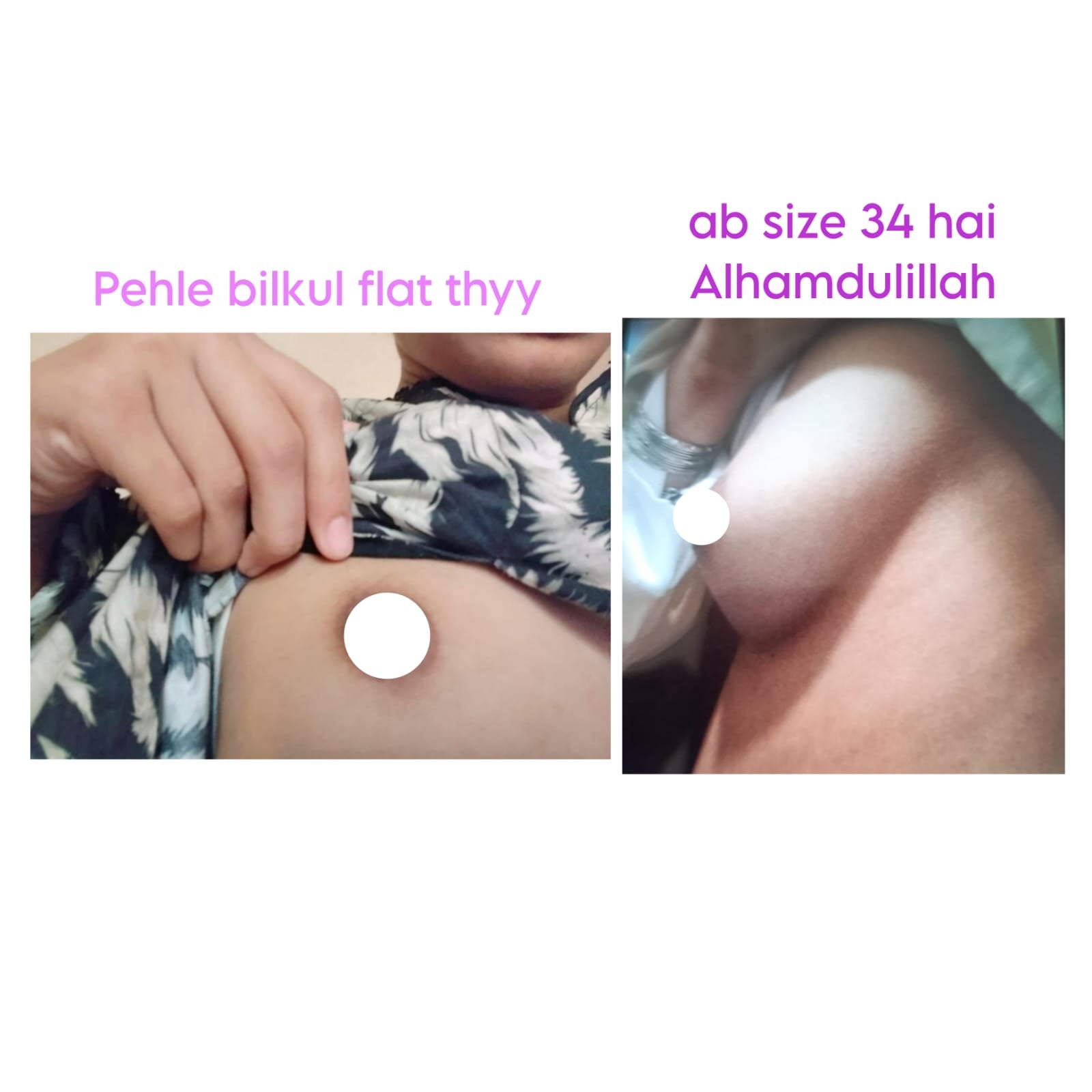 Breast Enlargement & Tightening Capsules - (GET RID OF SMALL BREASTS) (also good for Asymmetrical Breast)