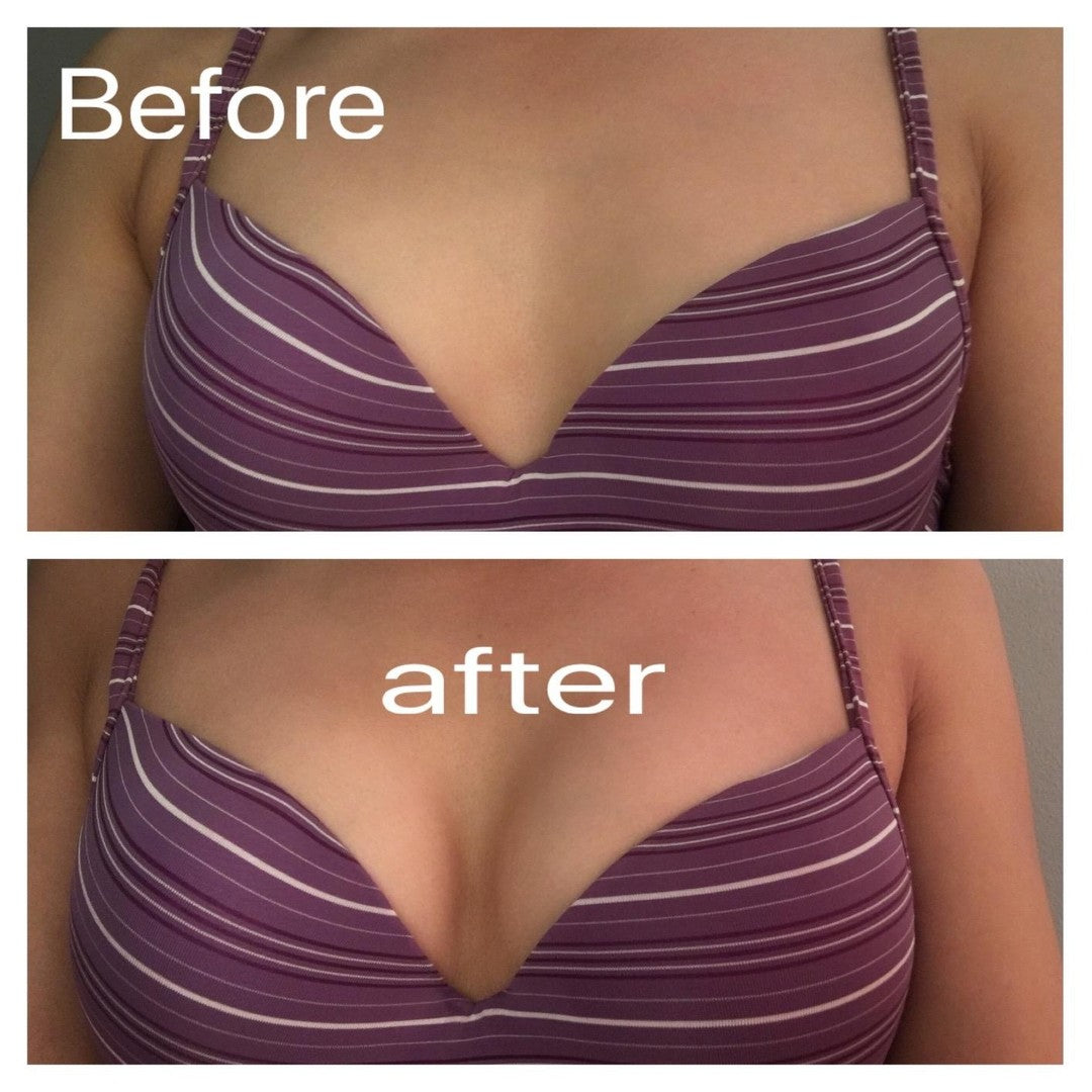 Breast Enlargement & Tightening Capsules - (GET RID OF SMALL BREASTS) (also good for Asymmetrical Breast)