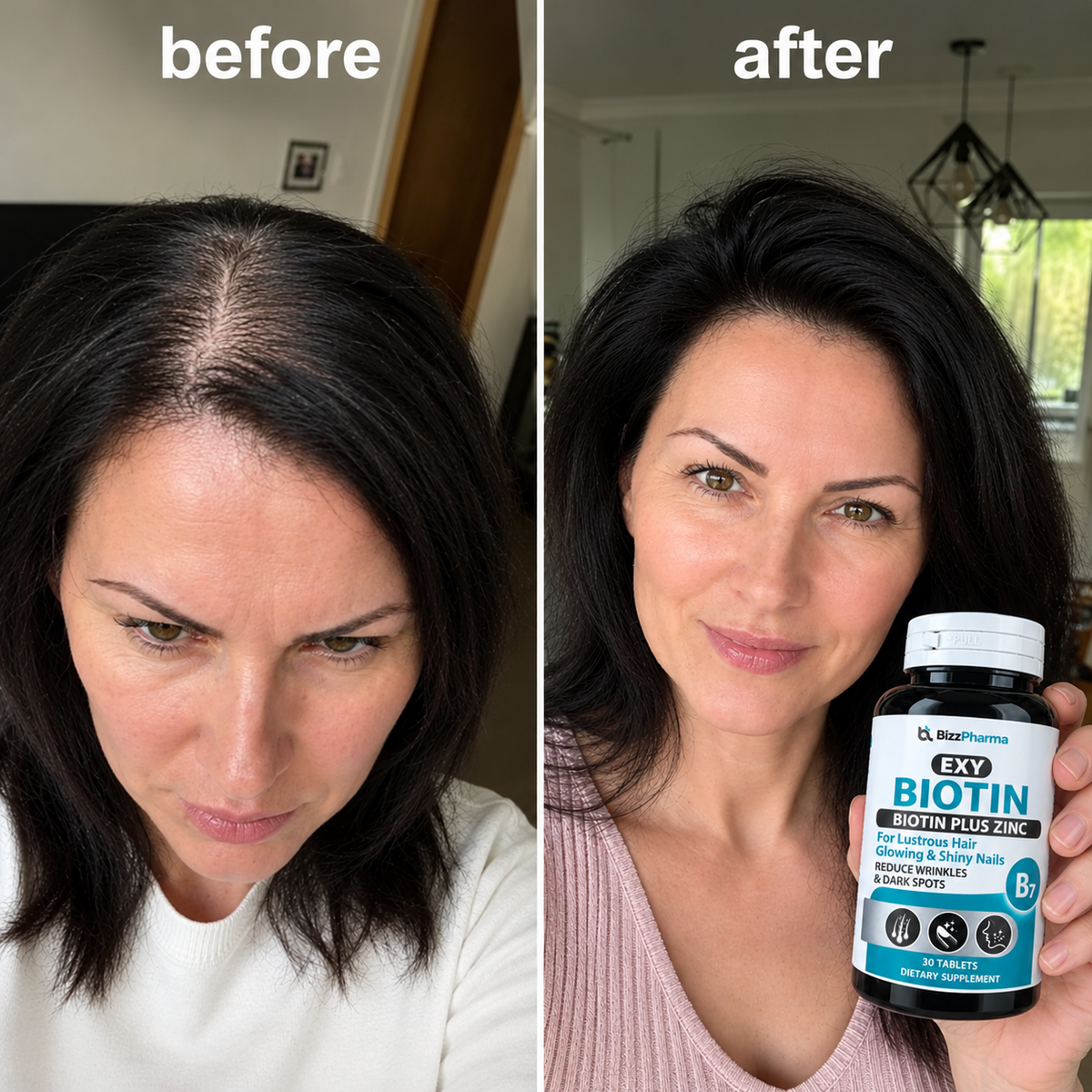 For Hair Growth - Anti Hairfall - Supports your Hair Growth - Biotin Plus Zinc (Supports your&nbsp;hair, nails, and overall nutritional needs) – 2500 mcg Biotin, 30 Tablets