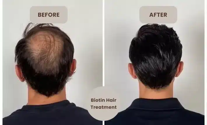 For Hair Growth - Anti Hairfall - Supports your Hair Growth - Biotin Plus Zinc (Supports your&nbsp;hair, nails, and overall nutritional needs) – 2500 mcg Biotin, 30 Tablets