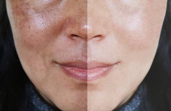 Body Whitening | Face Whitening -Glutathione with Vitamin C – Antioxidant Dietary Supplement, 30 Tablets