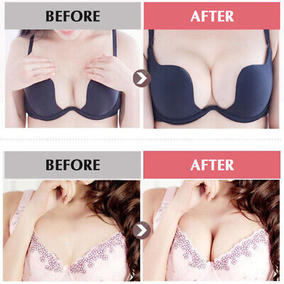 Breast Enlargement & Tightening Capsules - (GET RID OF SMALL BREASTS) (also good for Asymmetrical Breast)